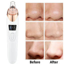 5-in-1 Rechargeable Blackhead Remover